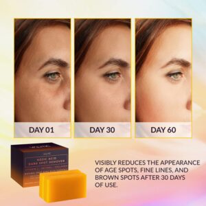 VALITIC Kojic Acid Dark Spot Remover Soap Bars Review